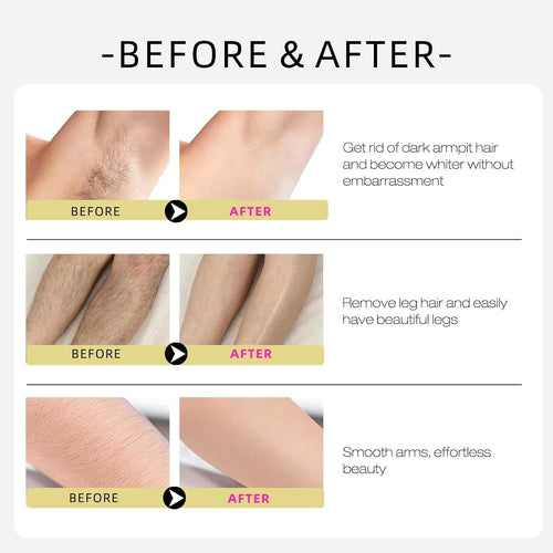 Cyperus Rotunduc Hair Removal Oil