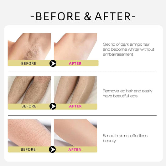 Cyperus Rotunduc Hair Removal Oil